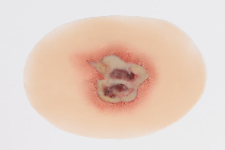 TraumaSim Infected Open Wound