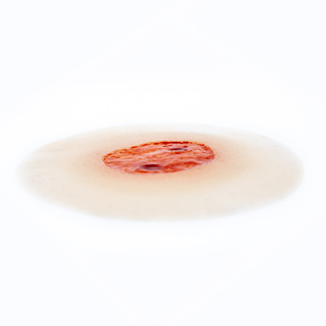 TraumaSim Ulcer - Large