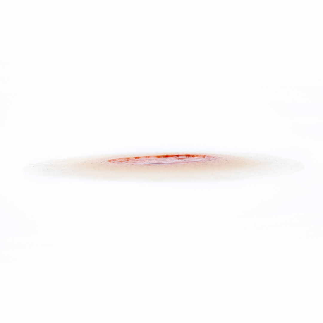 TraumaSim Ulcer - Large