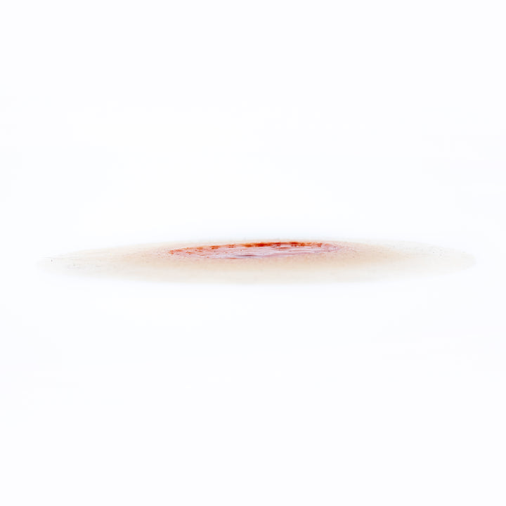TraumaSim Ulcer - Large