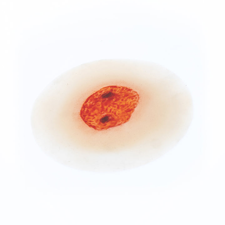 TraumaSim Ulcer - Large
