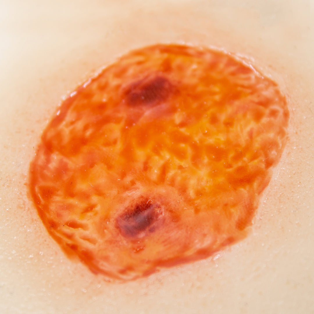 TraumaSim Ulcer - Large