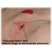 Hyfin Vent Compact Chest Seal - Twin Pack