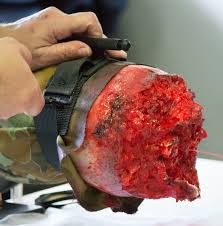 Tourniquet being applied to bleeding trainer leg by instructor during hands-on demo.