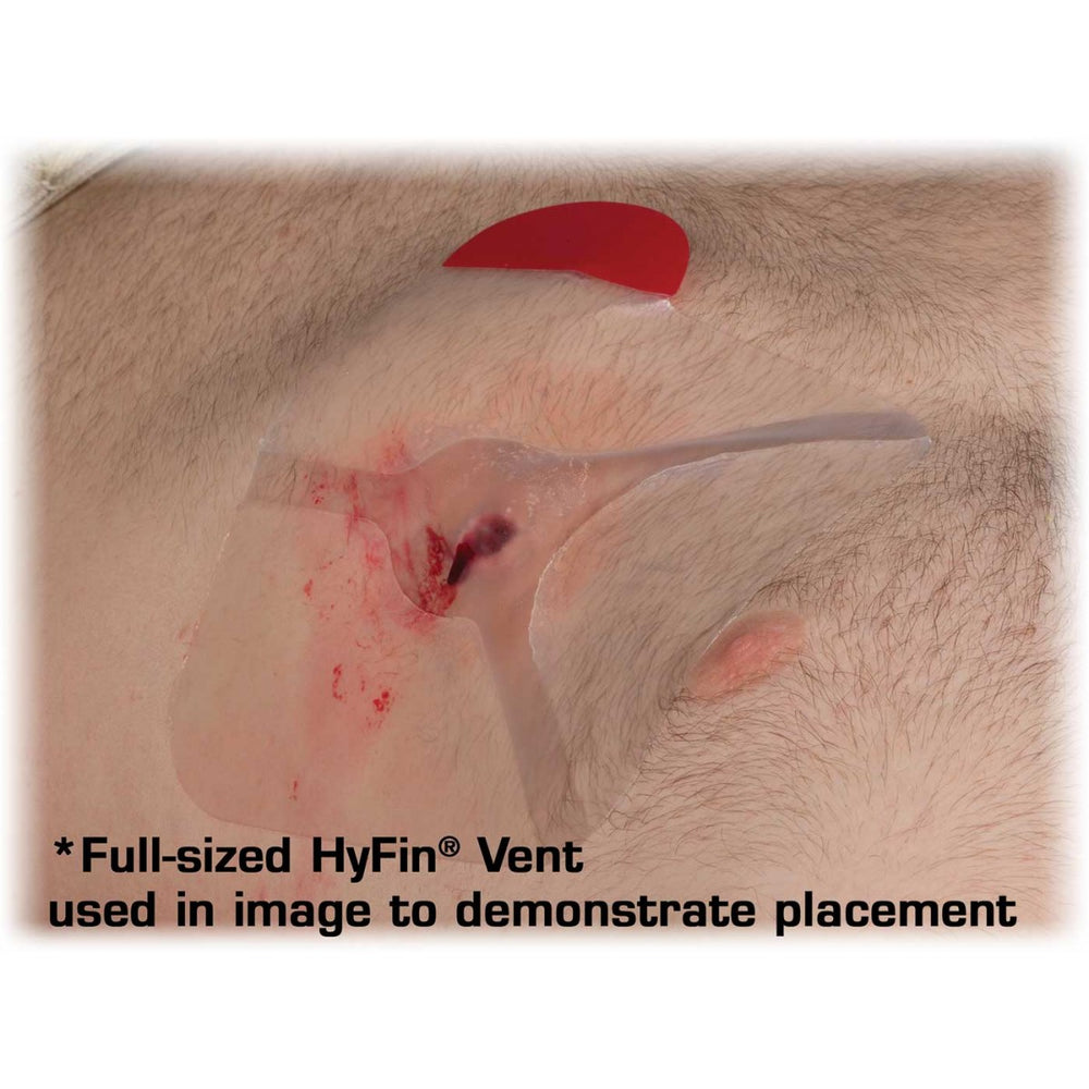 Full-sized Hyfin ent used in image to demonstrate placement on a penetrating chest wound