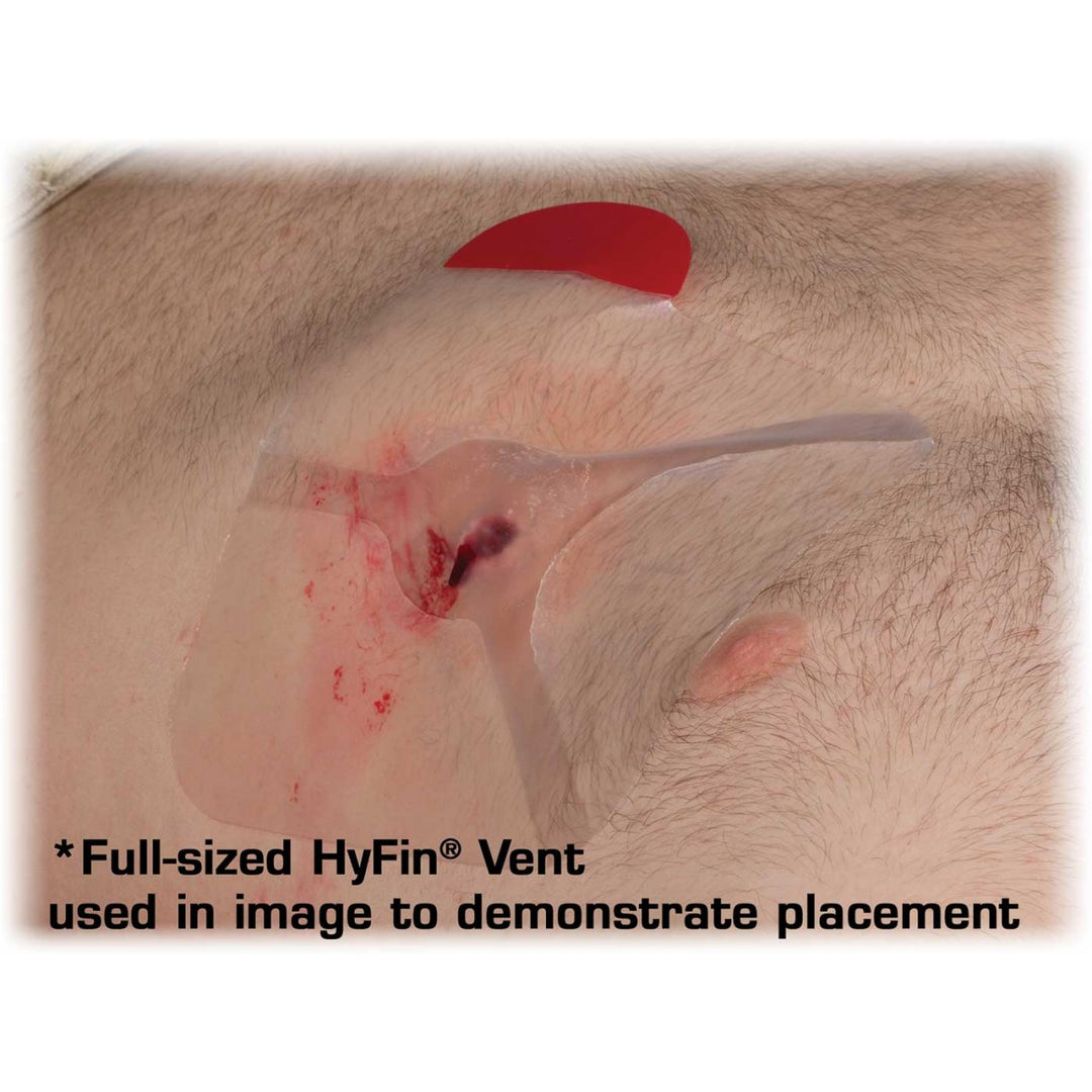 Full-sized Hyfin ent used in image to demonstrate placement on a penetrating chest wound