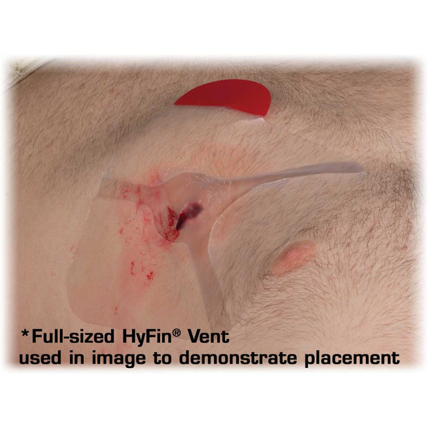 Full-sized Hyfin ent used in image to demonstrate placement on a penetrating chest wound